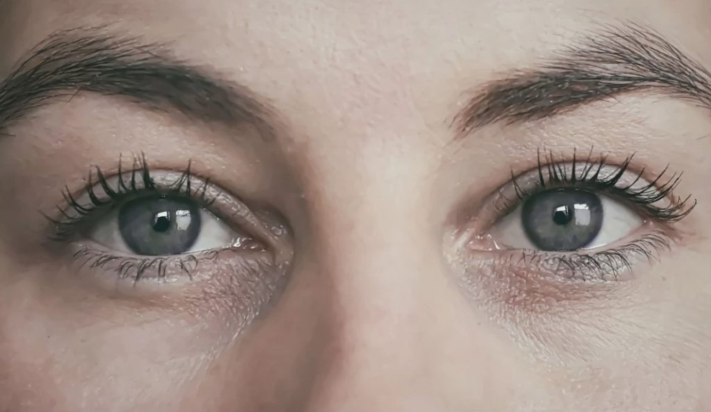 आंखों के डार्क सर्कल्स से हो गए हैं परेशान, तो इन 10 होममेड टिप्स को फॉलो करें