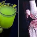 ऐसे बनाकर रोज पीएं Amla Juice, दोगुनी तेजी से अस्थियां होंगी पत्थर जैसी मजबूत, बूढ़ा होता शरीर बनेगा जवान