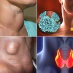 कैंसर और थायराइड का बढ़ता खतरा: जानें ये आयुर्वेदिक उपाय जो गंभीर बीमारियों पर लगा सकते हैं ब्रेक