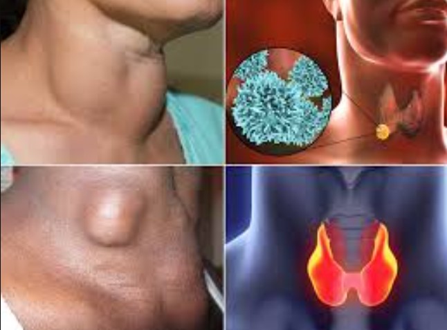 कैंसर और थायराइड का बढ़ता खतरा: जानें ये आयुर्वेदिक उपाय जो गंभीर बीमारियों पर लगा सकते हैं ब्रेक