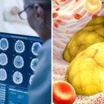 चीर-फाड़ के बिना पता लगाएं कितनी नसें हैं ब्लॉक, ऑपरेशन का पैसा जोड़ने की जरूरत नहीं, भर्ती भी नहीं होना